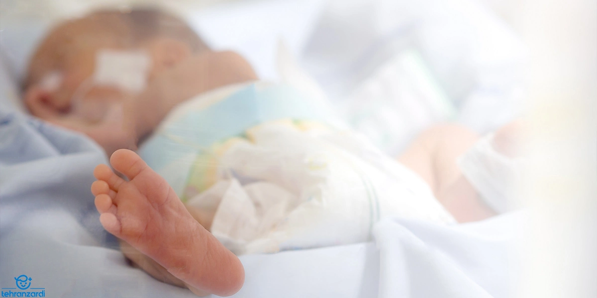 احتمال ابتلا به زردی در نوزادان نارس