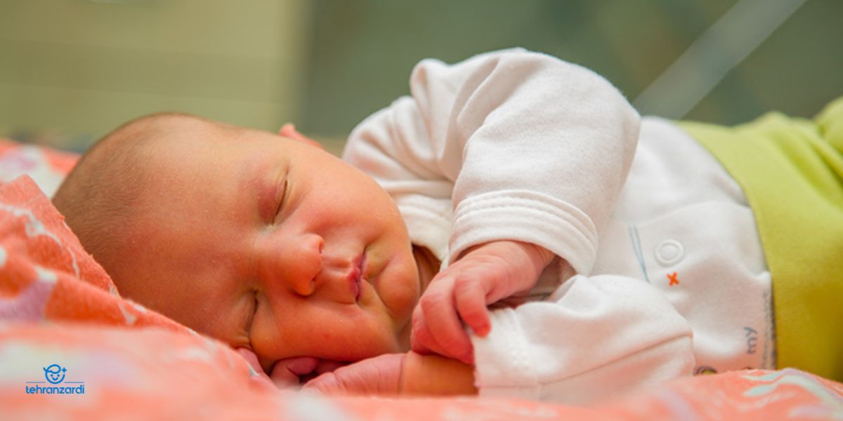 مهمترین نکات در درمان زردی نوزاد در منزل